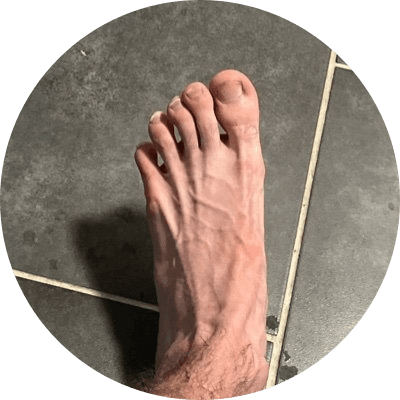 Foot To Millions Only logo